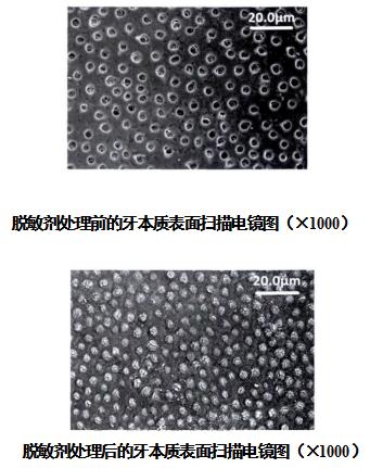 牙科脱敏剂注册审查指导原则（2021年第102号）(图2)