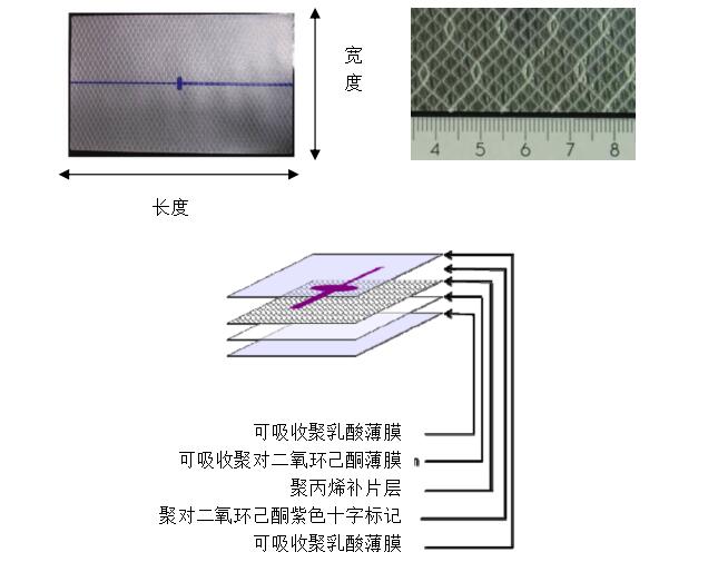 疝修补补片产品注册技术审查指导原则（2013年第7号）(图2)