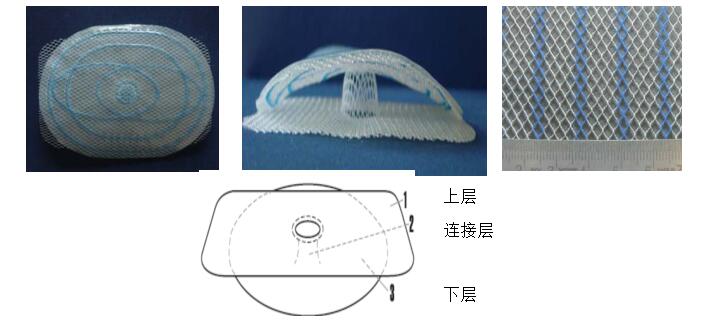 疝修补补片产品注册技术审查指导原则（2013年第7号）(图3)